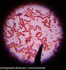 Photo of bacteria