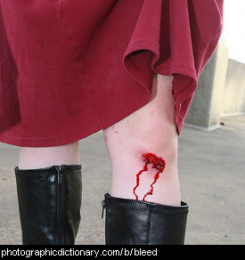 Photo of a bleeding knee