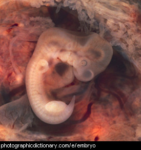 Photo of an embryo