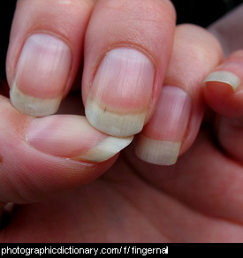Photo of fingernails