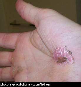 Photo of a healing hand