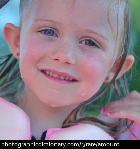 Photo of a girl with different colored eyes