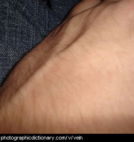 Photo of veins on an arm