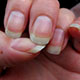 Photo of a womans fingernails