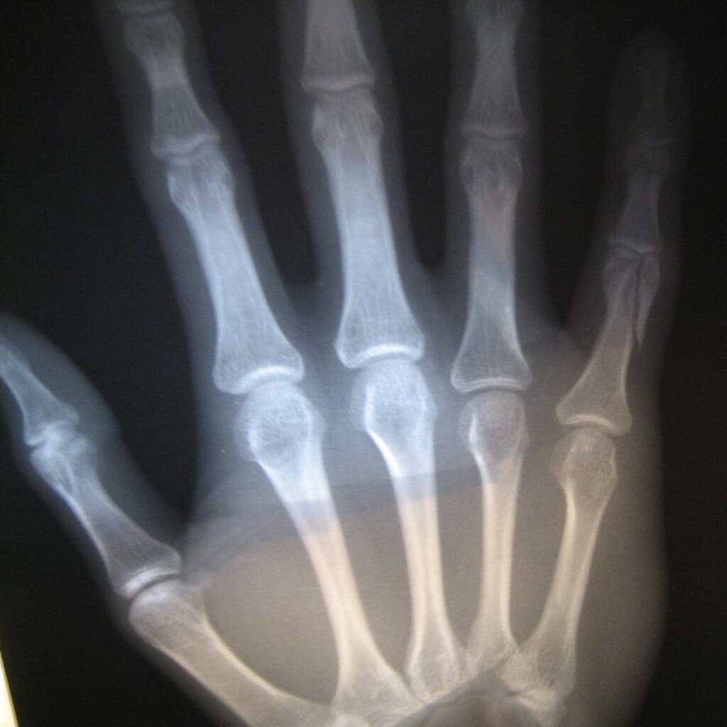 Photo of an x-ray film.